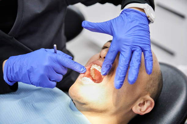 Best Emergency Dentist for Lost Fillings or Crowns in Mowbray Mountain, TN