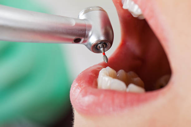 Best Emergency Dental Extractions in Mowbray Mountain, TN